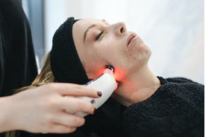skin laser treatment