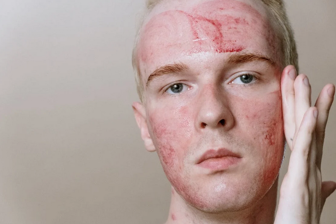 exfoliate